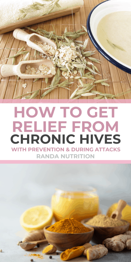 How to Get Relief from Chronic Hives